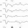 a-scope.png